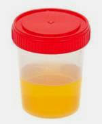 urine sample